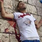القدس المحتلة: اصابة شاب بجروح خطيرة برصاص شرطة الاحتلال