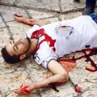 القدس المحتلة: اصابة شاب بجروح خطيرة برصاص شرطة الاحتلال