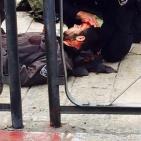 القدس المحتلة: اصابة شاب بجروح خطيرة برصاص شرطة الاحتلال