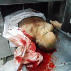 شهيد بيت أمر فلاح أبو مارية ونجله المصاب محمد