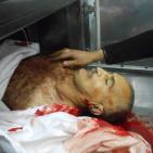 شهيد بيت أمر فلاح أبو مارية ونجله المصاب محمد