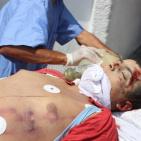 بالصور.. 4 شهداء وعدة اصابات بانفجار كبير في رفح