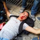 جرحى  مقدسيون بسياط وبنادق الارهابيين الاسرائيليين  في المسجد الاقصى اليوم الاحد 13-9-2015