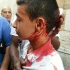 جرحى  مقدسيون في مواجهات  مع المحتلين في الاقصى اليوم 15/9/2015