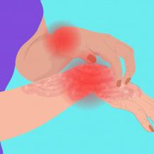 الحكة المستمرة غير المبررة قد تكون مؤشرًا على خطر صحي