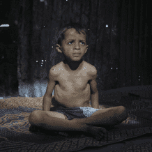 الأمم المتحدة: عدد حالات سوء التغذية الحاد بغزة ارتفع إلى 95 ألفا