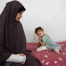 عدد الأطفال مبتوري الأطراف في غزة الأكبر بالعالم: الذخائر غير المنفجرة تهدد جهود إعادة الإعمار