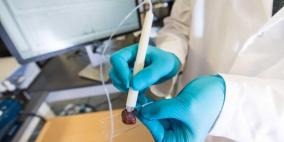 قلم يكشف الخلايا السرطانية في 10 ثوان