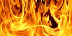 اصابة سيدة بحروق نتيجة اندلاع حريق داخل منزل في بلدة جبع