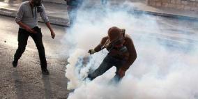 إصابة بالرصاص المعدني وعشرات حالات الاختناق في نعلين