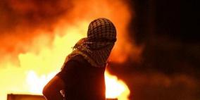 مصدر طبي لــ"رايــة" اقتلاع عين شاب اصيب في مواجهات قلقيلية