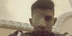 فقد عينه اليسرى قبل شهرين .. واليوم يسلم نفسه