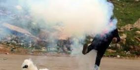 إصابة مواطن بقنبلة غاز برأسه واحتراق أشجار زيتون بمسيرة كفر قدوم