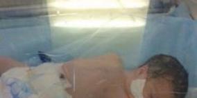 مشفى الخليل ينقذ طفلا من بطن امه المتوفيه