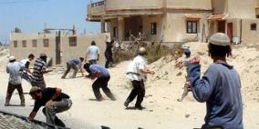 إصابة مواطن في اعتداء للمستوطنين شرق قلقيلية