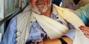 نابلس: مستوطنون يحرقون حقول زيتون ويعتدون على متضامن بريطاني في بورين