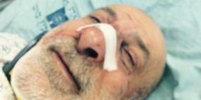 مستوطن يعتدي على سائق مقدسي