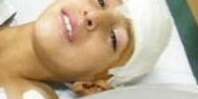 "خلاط" اسمنت يتسبب في بتر ساقي طفل من القدس