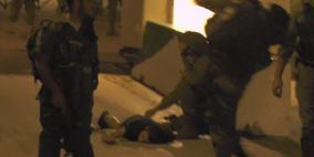 بالصور.. اعتقال شاب بعد اصابته بالرصاص الحي