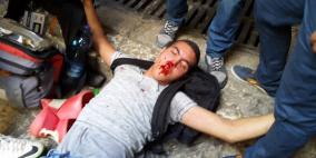 جرحى  مقدسيون بسياط وبنادق الارهابيين الاسرائيليين  في المسجد الاقصى اليوم الاحد 13-9-2015