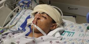 انتهاء تشريح جثمان الشهيد سنقرط والاحتلال يضع شروطاً لدفنه