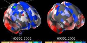 أطلس للدماغ يظهر كيفية انتظام الكلمات في المخ