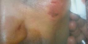 رام الله: قوات الاحتلال تعتقل شابا وتعتدي على اثنين من عائلته