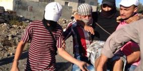 إصابة شاب بالمطاط و6 حالات بالاختناق على مدخل قلقيلية الجنوبي