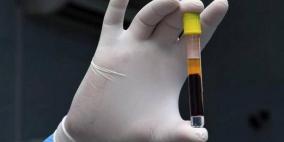 عدد المصابين الفعلي بكورونا في امريكا أكبر بما بين ضعفين و13 ضعفا