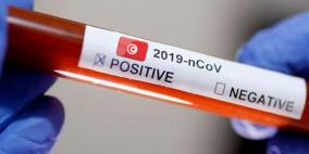 الأردن: 38 وفاة و2821 إصابة جديدة بفيروس كورونا