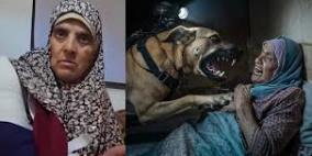 منظمة حقوقية: استخدام الاحتلال الكلاب للاعتداء على الفلسطينيين أمر ممنهج