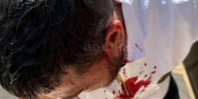 إصابة شاب في اعتداء الاحتلال على مصلين قرب باب الأسباط