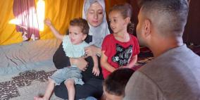 حنان المدهون… عيون أُطفئت وحياة انهارت بنيران العدوان