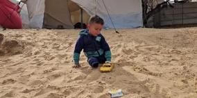 وزارة الصحة: غزة تسجّل أعلى معدل لبتر الأطراف لدى الأطفال نسبةً لعدد السكان عالمياً