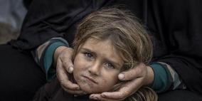 "اليونيسف" تحذر من تفشي الأمراض بين أطفال غزة