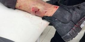 إصابتان برصاص الاحتلال في بلدة الرام