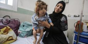 خاص | تحذيرات من تفشٍ خطير للحمى الشوكية في غزة وسط سوء تغذية