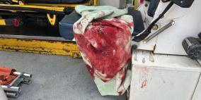 إصابة طفلين برصاص الاحتلال شرق مخيم المغازي وسط غزة