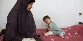 عدد الأطفال مبتوري الأطراف في غزة الأكبر بالعالم: الذخائر غير المنفجرة تهدد جهود إعادة الإعمار