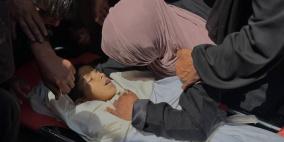 ارتفاع حصيلة الشهداء في قطاع غزة إلى 72,599 منذ بدء العدوان