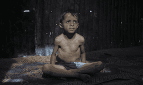 اليونيسف تحذر من ارتفاع مستويات سوء التغذية لدى الأطفال والحوامل في غزة