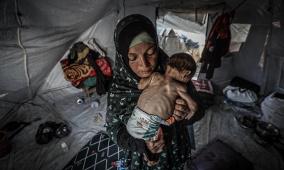 3 وفيات نتيجة التجويع في غزة خلال الساعات الـ24 الماضية