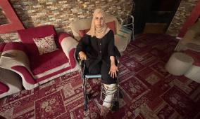 خاص| بعد فقد أربع بنات وساق مبتورة.. حنين تصرخ من أجل الحياة