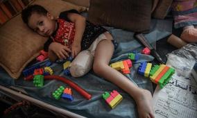 42 ألف إصابة مُعطِّلة للحياة في غزة: رقم يكشف حجم الكارثة الصامتة