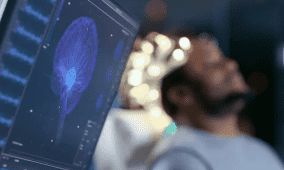 دراسة: اضطراب الساعة البيولوجية قد ينذر بالإصابة المبكرة بالخرف