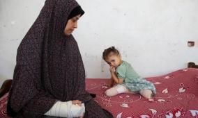 عدد الأطفال مبتوري الأطراف في غزة الأكبر بالعالم: الذخائر غير المنفجرة تهدد جهود إعادة الإعمار