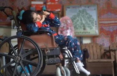 منظمة أمريكية تُحذّر: 6 آلاف مبتور في غزة يحتاجون إعادة تأهيل عاجل ودعم نفسي 