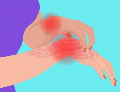 الحكة المستمرة غير المبررة قد تكون مؤشرًا على خطر صحي