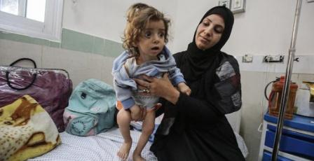 خاص | تحذيرات من تفشٍ خطير للحمى الشوكية في غزة وسط سوء تغذية