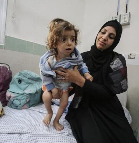 خاص | تحذيرات من تفشٍ خطير للحمى الشوكية في غزة وسط سوء تغذية